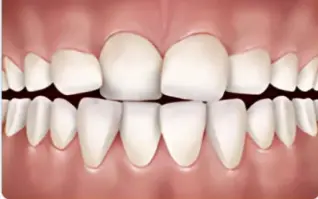 Crowded Teeth icon