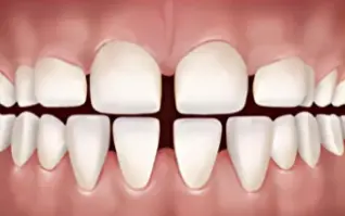 Gaps in Teeth icon