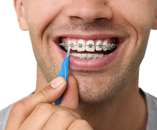 Interdental Brushes