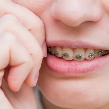 person with braces