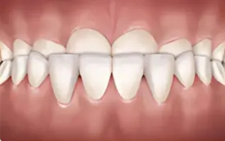 Underbite icon